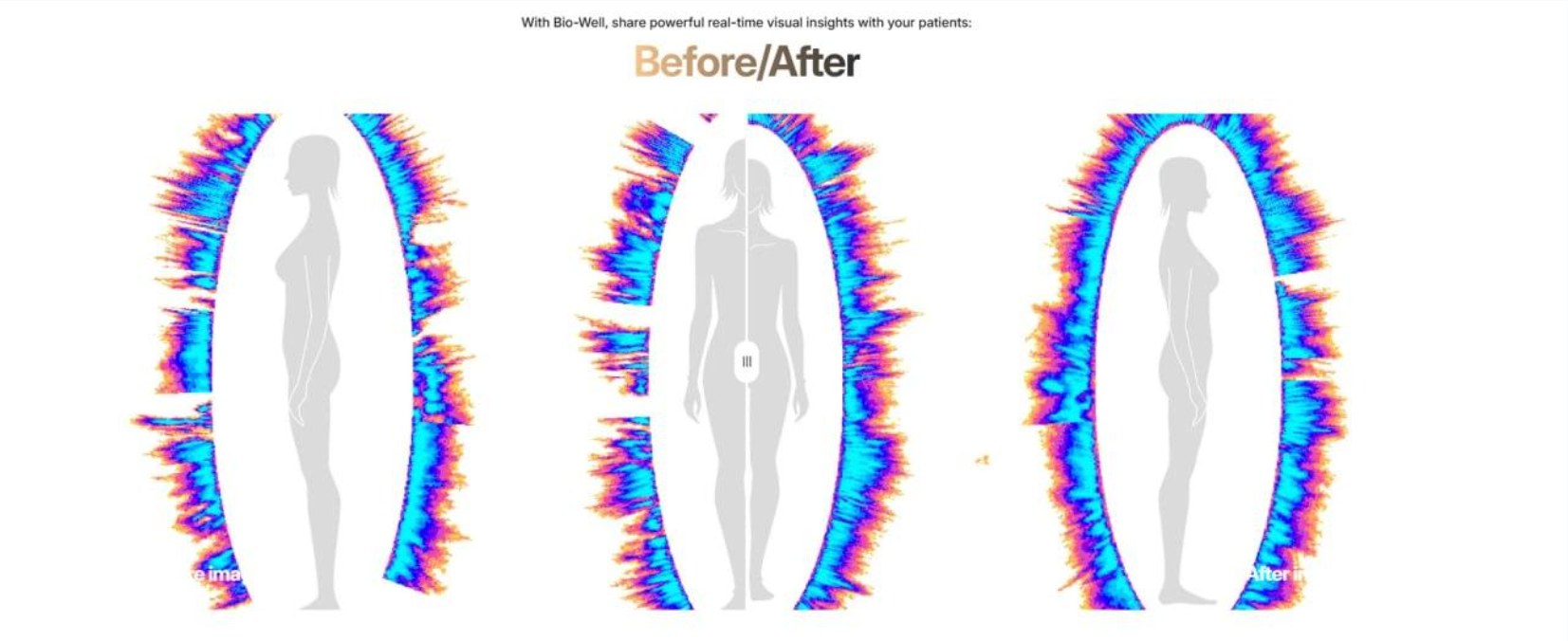 Bio-Well before and after comparison showing three energy field scans of a human figure, the outlines rendered in blue, violet and orange